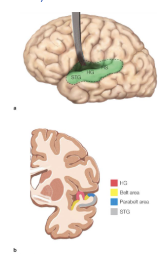 <p><em>auditory cortex</em> </p>