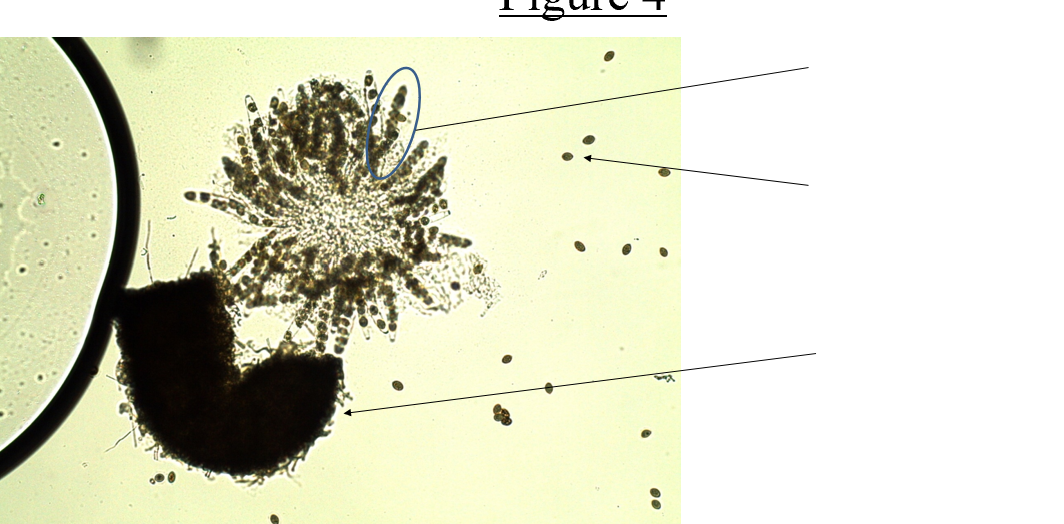 <p>Figure 4 (ascomycota); what type of reproduction is shown here</p>