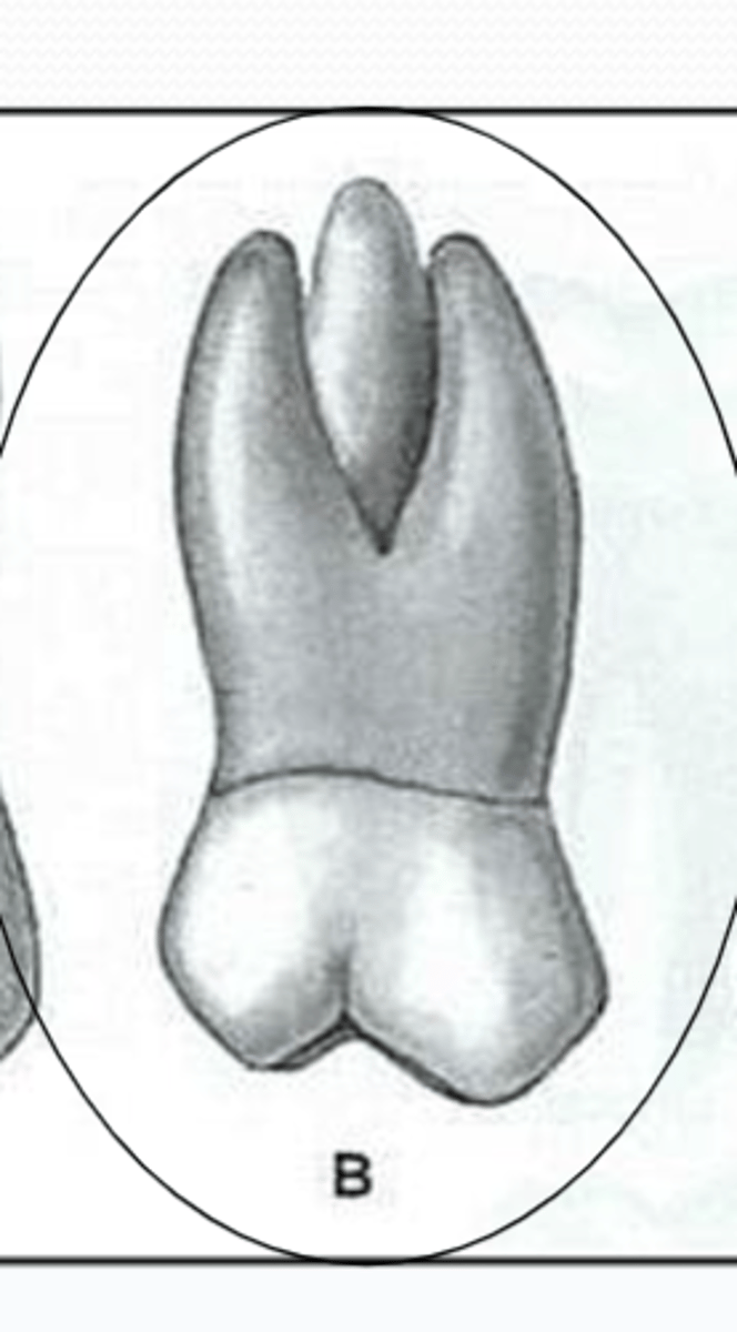 <p>smaller and less divergent as compared to a Mx 1st molar</p>