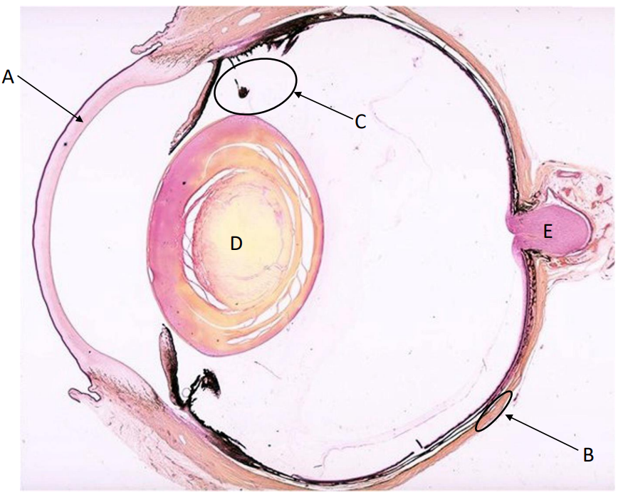 <p>Corpus ciliaris</p>