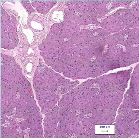 <p>What is the Parotid Gland?</p>