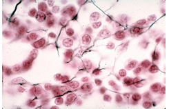 <ul><li><p>specialized connective tissue</p></li><li><p>is a delicate network of interwoven reticular fibers forming a supportive framework for blood vessels and internal organs </p></li></ul><p></p>