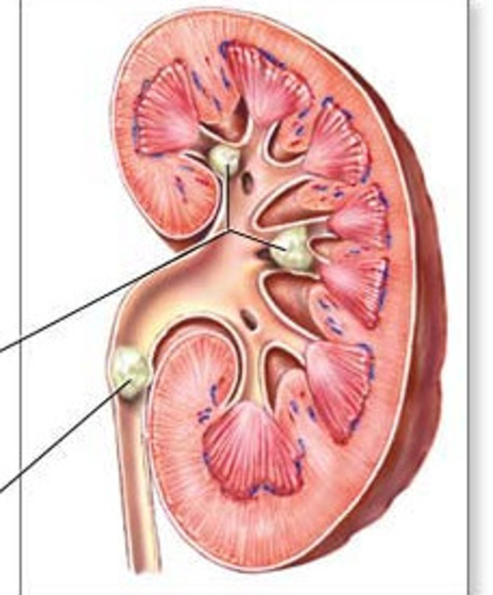<p>• Stone Analysis (give them a strainer!)</p>
