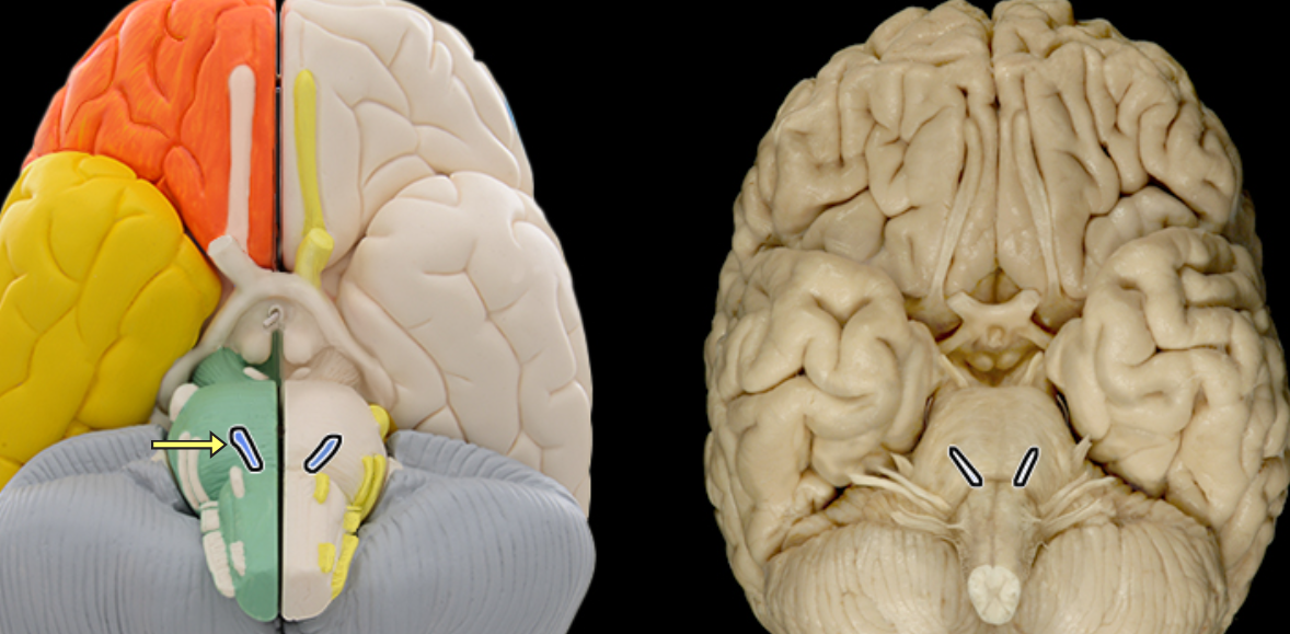 <p>Abducens n. CNVI</p>