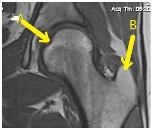 <p>What anatomy is letter B?</p>