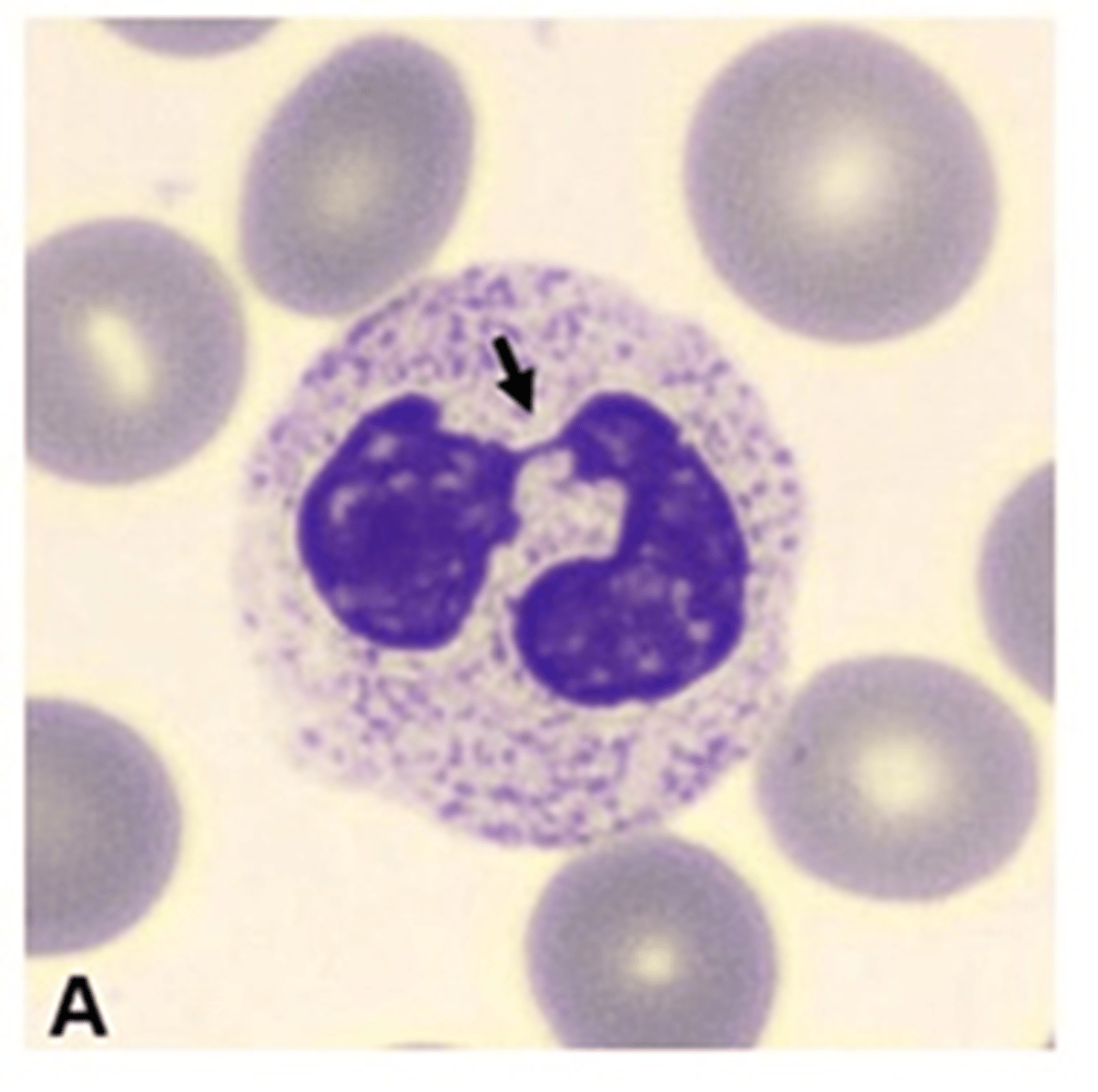 <p>pink or tan to clear, containing many secondary granules, tertiary granules, and secretory vesicles.</p>