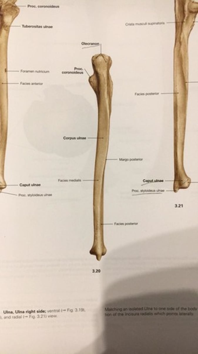 <p>corpus ulnae</p>