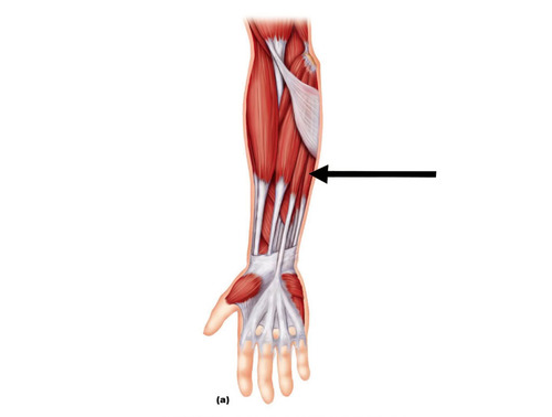 wrist flexion PM, adduction