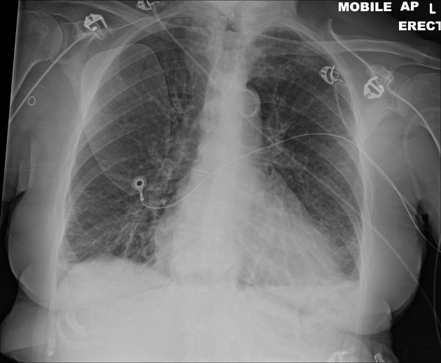 <p>Describe the abnormality demonstrated.</p>
