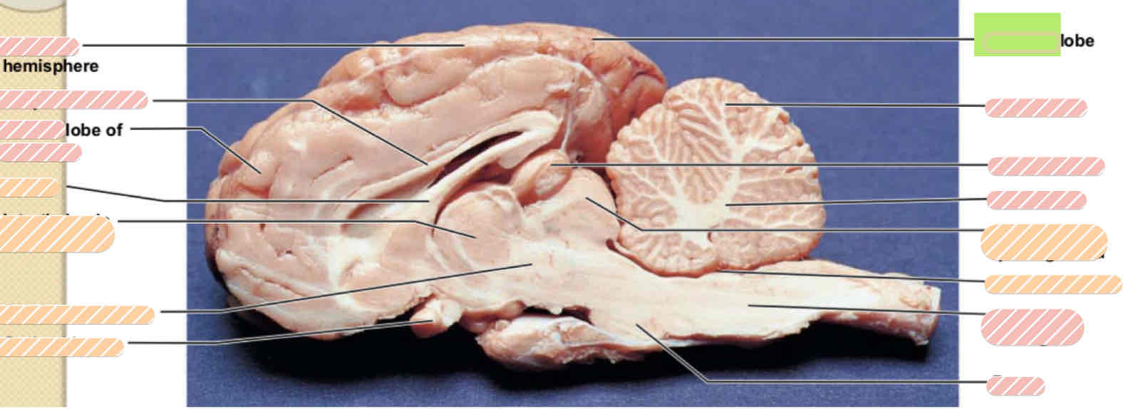 <p><span>Sheep brain (lobe)</span></p>