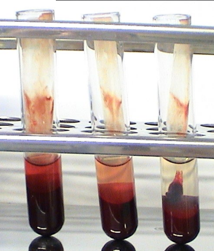 <ol><li><p>2ml blood from two animals and a control animal in glass tubes with anticoagulant to clot at 37 degrees</p></li><li><p>After 1 hour, compare clot retraction in 3 vials and serum prod should be 30-50%</p></li></ol><p></p>