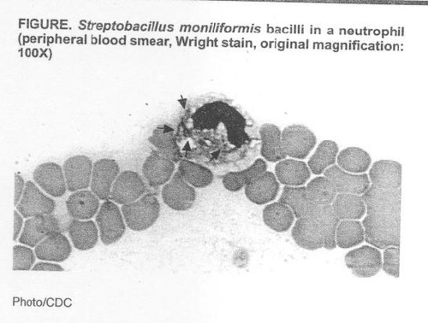 <p>Through a bite from a rat or ingestion of contaminated milk.</p>