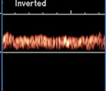 <p>what type of resistance waveform does this show (venous)?</p>