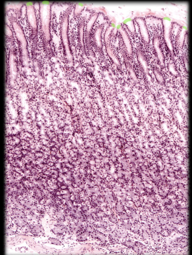 knowt flashcard image