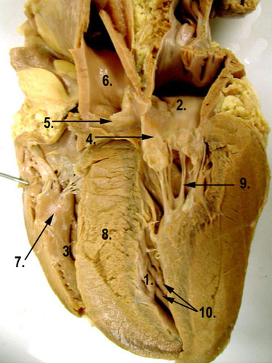 <p>Identify the structure labeled 8.</p>