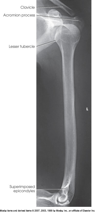 <p>What position is demonstrated?</p>