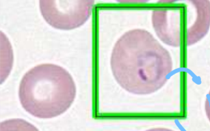 <p>ring-like organisms f<strong>ound only intracellularl</strong>y, as well as in different stages&nbsp;</p>