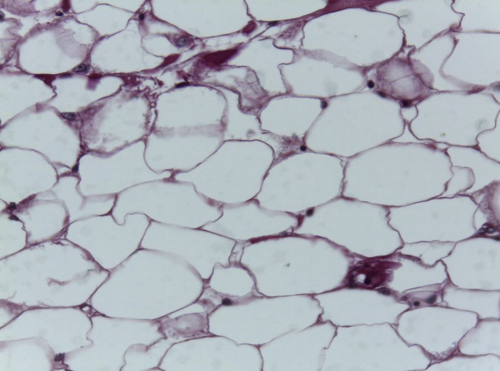 <ol><li><p><strong>Name the tissue type</strong></p></li><li><p><strong>Know where it is found in the body</strong></p></li><li><p><strong>What fill’s each bubble?</strong></p></li></ol><p></p>