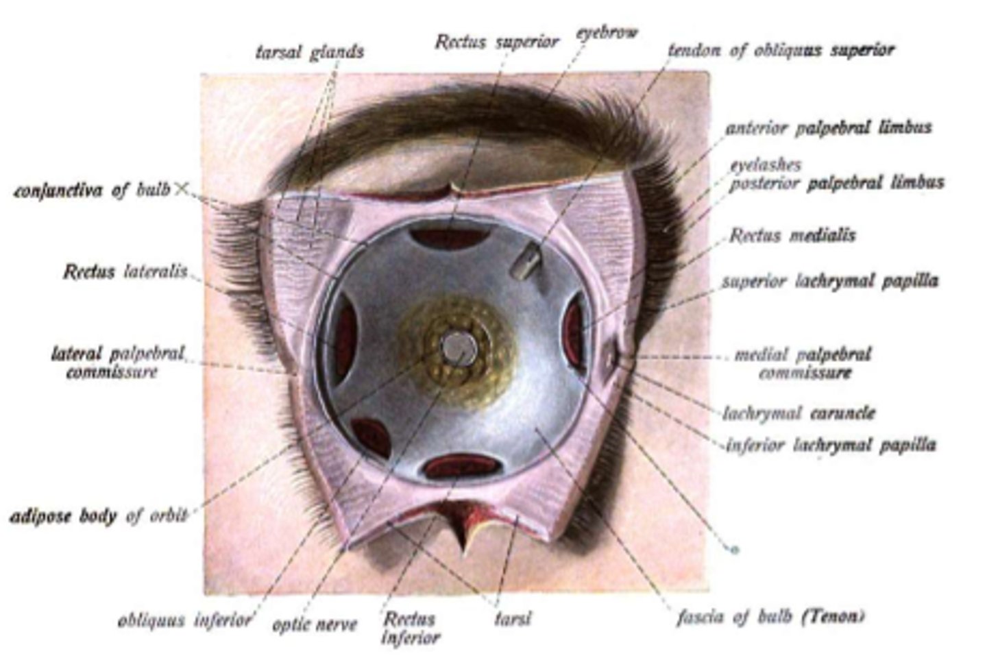 <p>connective tissue <br>-the socket in which the globe is suspended; kept intact for ocular prosthesis</p>