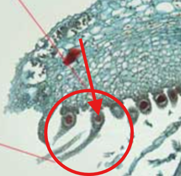 <p>What part of the Archegonial Head is the arrow pointing to?</p>
