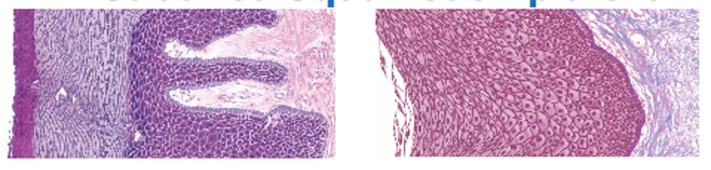 <p>- deepest layers undergo continuous mitosis (daughter cells push toward surface and become flatter as they migrate)</p><p>- 2 kinds:</p><p>keratinized</p><p>non-keratinized</p>