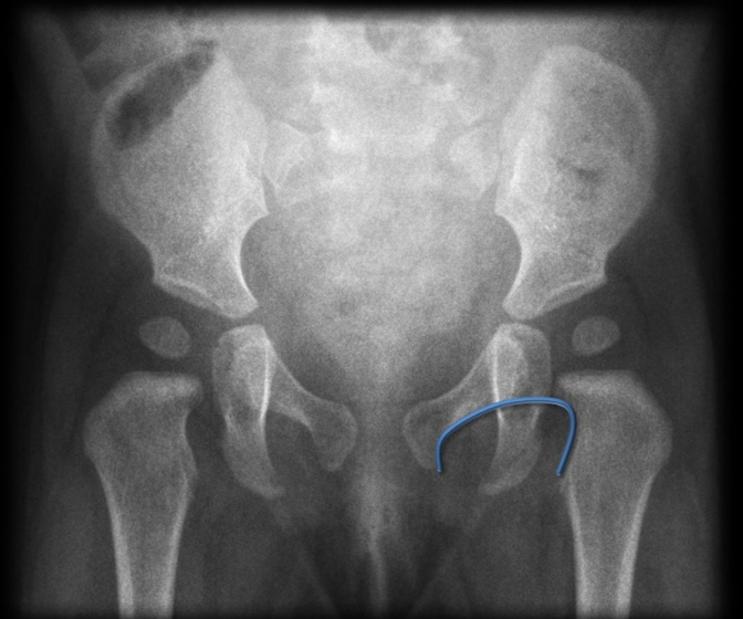 <p>What does this image indicate</p>