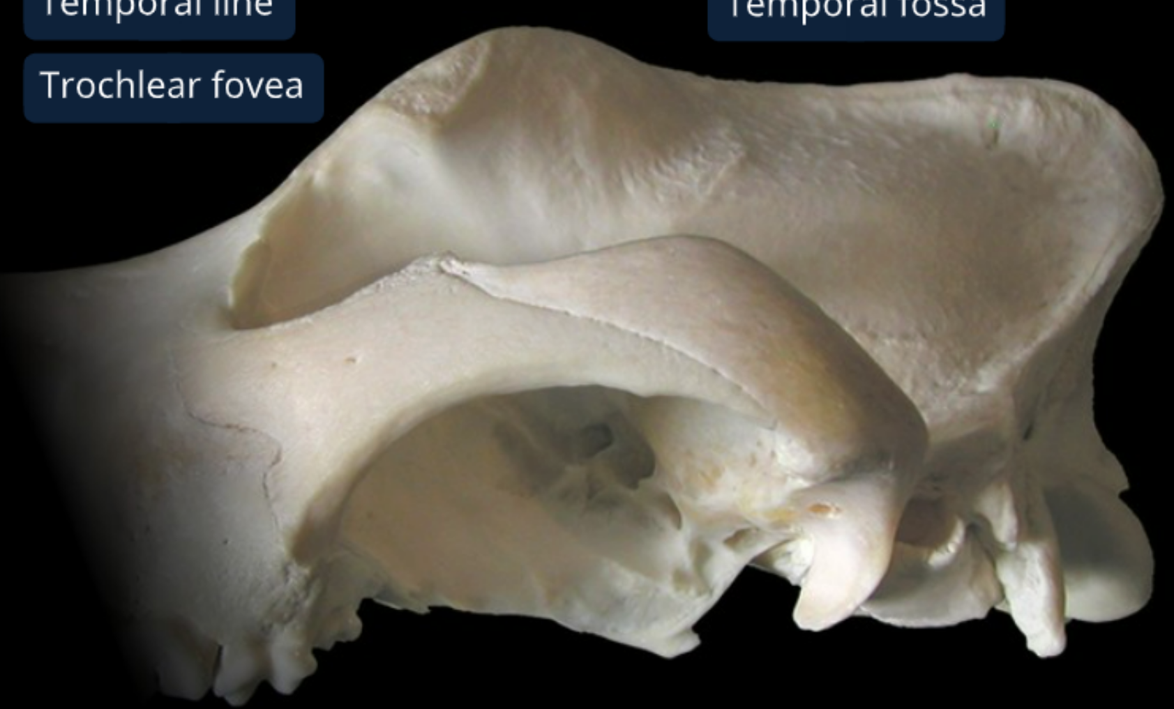 <ol><li><p>external acoustic meatus: allows air to flow from external ear to tympanic membrane</p></li><li><p>tympanic bulla: thin walled air filled part of middle ear </p></li><li><p>zygomatic arch</p></li><li><p>frontal bone: forms forehead</p></li><li><p>zygomatic process of frontal bone: attaches palpable ligament to complete the orbit</p></li><li><p>parietal bone: forms shape of the head </p></li><li><p>temporal fossa: convex surface where temporalis m. originates</p></li></ol><p></p>