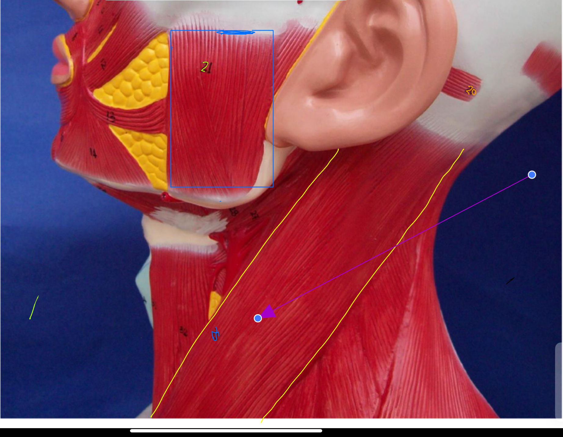 <p>What type of muscle is this ( altay model)</p>