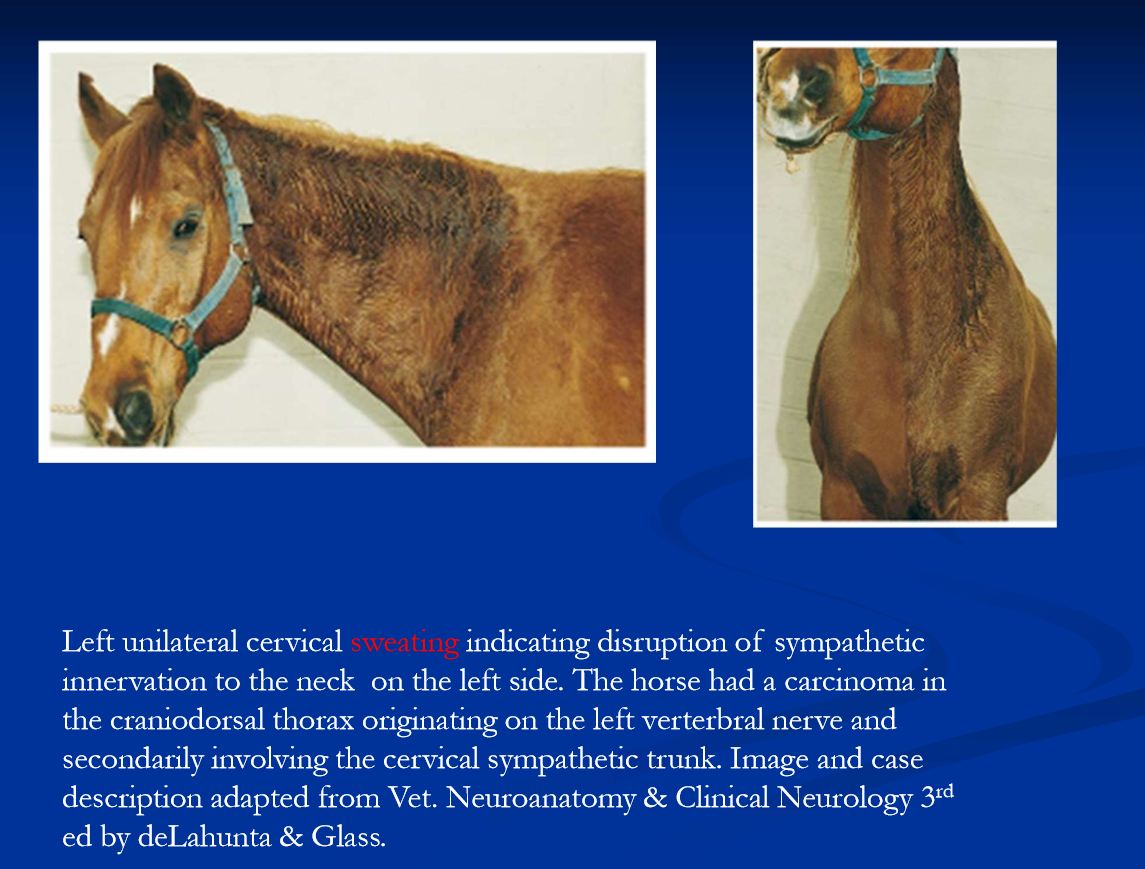 <ul><li><p>signs are <strong>ptosis, enophthalmus, 3rd eyelid prolapse, miosis </strong></p></li><li><p><strong>facial sweating in horses </strong></p><ul><li><p>focal sweating occurs with any local sympathic injury in horses </p></li><li><p>the pattern of sweating is helpful in localizations </p></li></ul></li><li><p>some <strong>causes of horner syndrome in horses include </strong></p><ul><li><p>cranial trauma </p></li><li><p>GP disease </p></li><li><p>cervical injuries ex injection site injury***</p></li><li><p>spinal cord disease or injury at T2 </p></li><li><p>brachial plexus / nerve root disease or injury (avulsion) </p></li><li><p>thoracic trauma or mass </p></li></ul></li></ul><p></p>