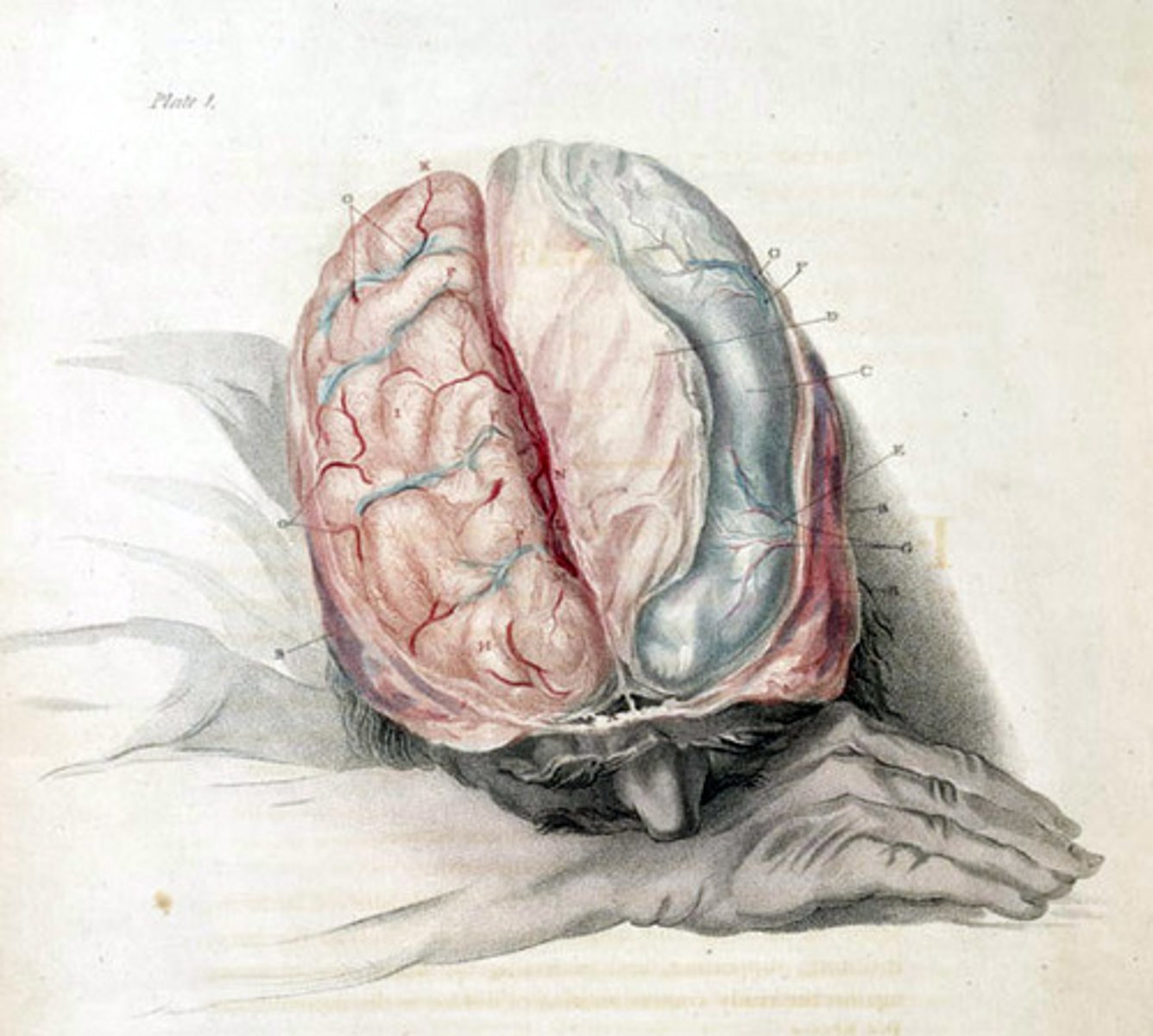 <p>characterized by dissociations from consciousness, memory, identity, emotion, perception, body, motor, and behavior</p>