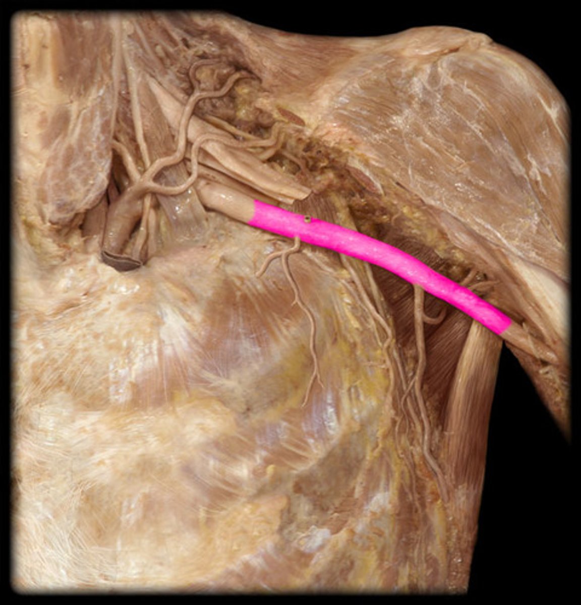 <p>What structure is shown?</p>