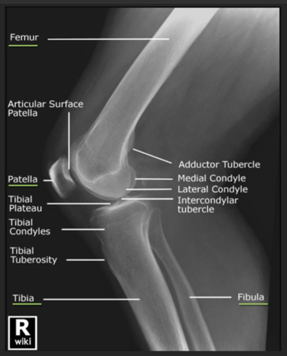 <p>- to include the knee joint, distal third of the femur, proximal third of the tibia and fibula and lateral soft tissue borders.</p><p>ALSO:</p><p>▪ The femoral condyles should be superimposed</p><p>▪ The patella should be clear of the femur</p><p>▪ Patellofemoral joint space demonstrated</p><p>▪ Approx 1/3rd of the head of fibula superimposed over the tibia</p>