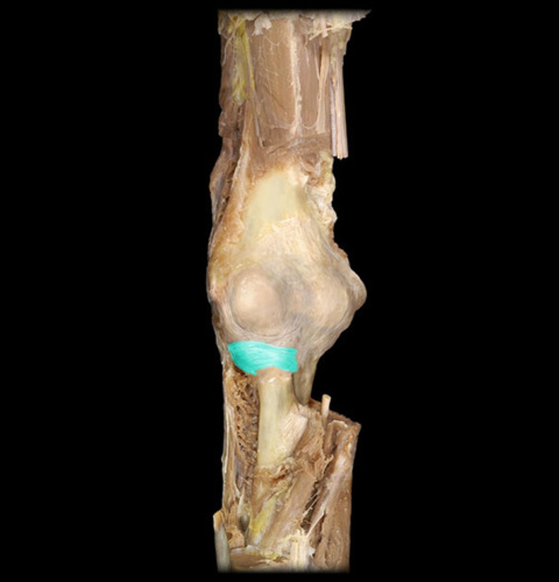 <p>ring-shaped band of connective tissue below the elbow joint that encircles the head of the radius</p>