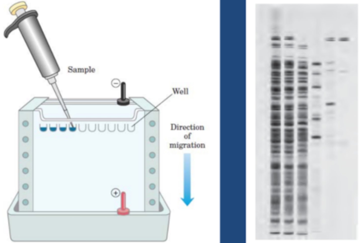 Biochemistry Yr2 Isoelectric Point, Electrophoresis, Electrophoretic