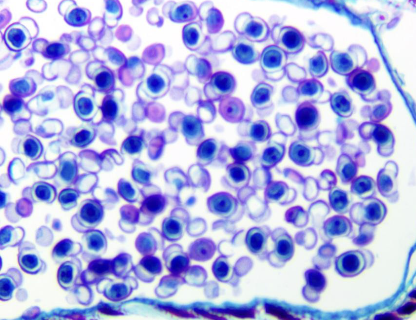 <p>This is a cross-section of a pollen cone. what are the circular structures called?</p><ul><li><p>Pollen grains</p></li><li><p>Sori</p></li><li><p>Megasporangia</p></li><li><p>Gemma Cups</p></li></ul><p></p>
