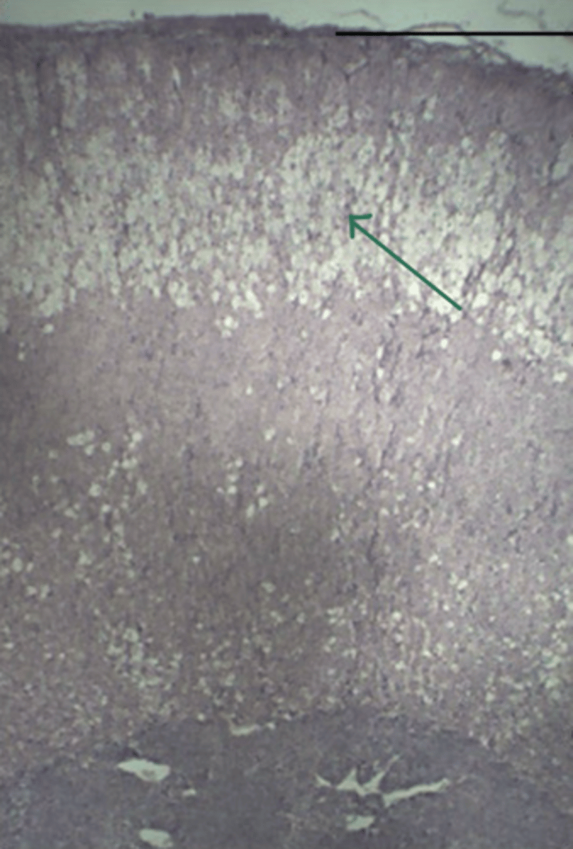 <p>gland and structure</p>