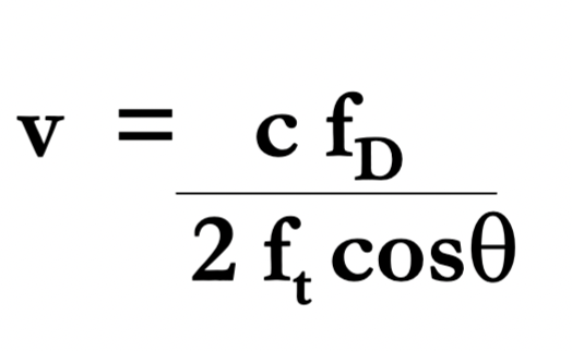 <p>What is the target velocity, whats the equation?</p>