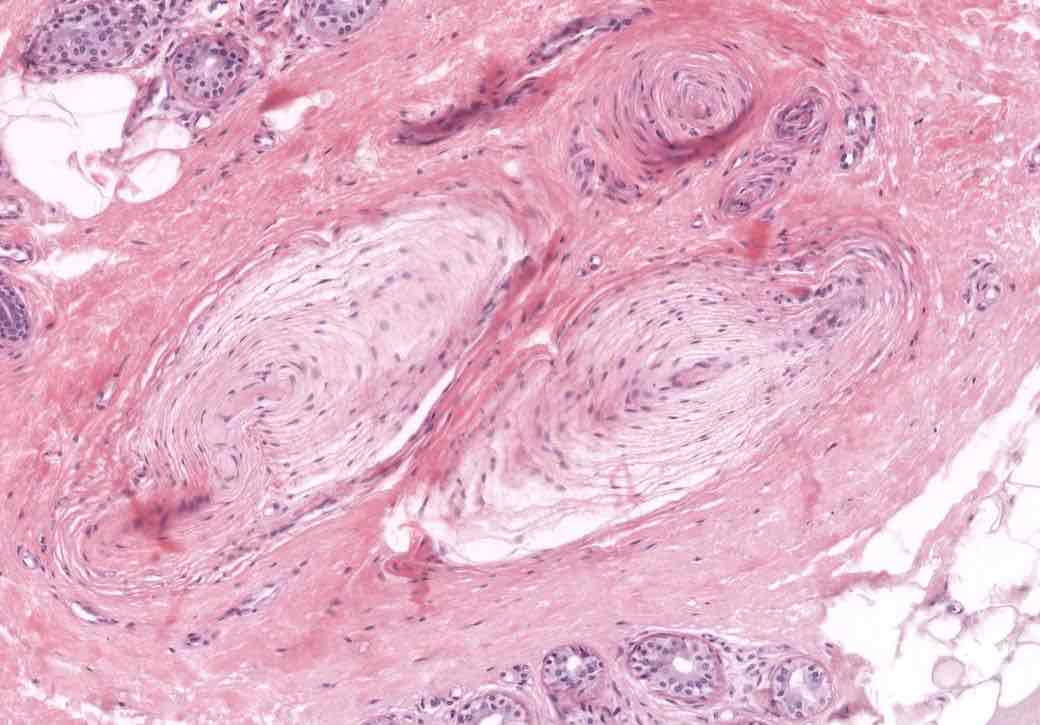 <p>Can you identify this sensory receptor? provide function, location and structure </p>