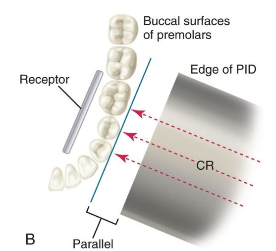 <p>The PID is positioned so the central beam is directed <strong>through the contact areas</strong> and hits the receptor <strong>perpendicularly</strong>. This prevents overlapped contacts.</p>
