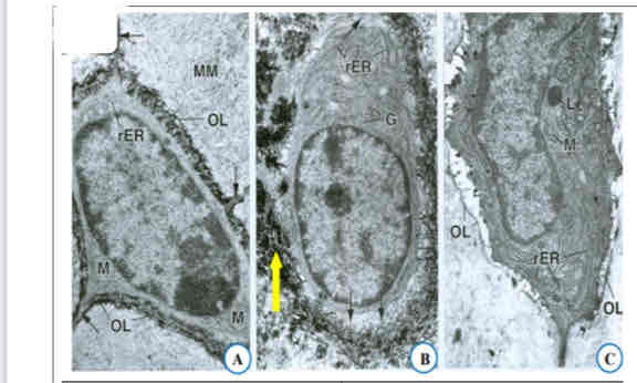 term image