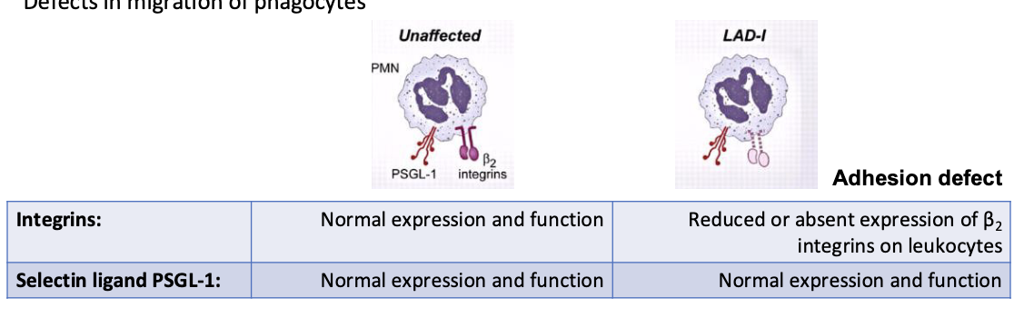 <p>defects in migration of phagocytes</p><ul><li><p>reduced or absent expression of B2 integrins on leukocytes</p></li><li><p>patients deficient in expression of the 3 integrins containing CD18 (LFA-1 (CD11a/CD18) MAC-1 (CD11b/CD18), Gp 150/95 (CD11c/CD18)</p></li></ul><p></p>