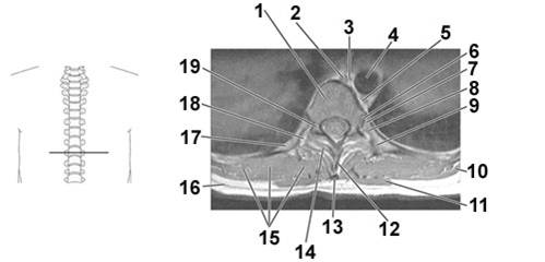 <p><span>thoracic duct</span></p>
