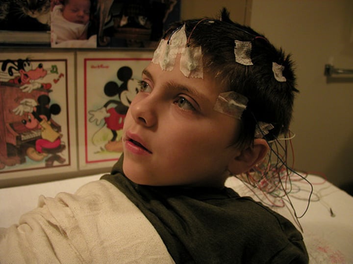 <p>An amplified recording of the waves of electrical activity that sweep across the brain's surface. These waves are measured by electrodes placed on the scalp.</p>