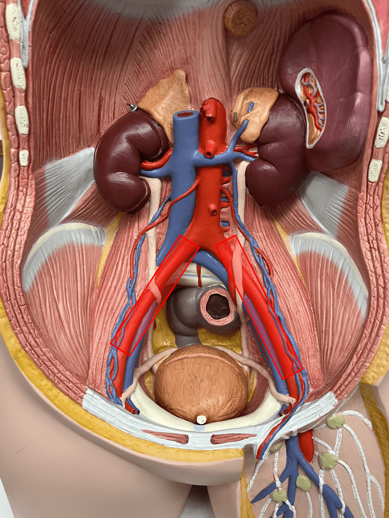 <p>• An artery of the abdomen.</p>
<p>• Originates as the continuation of the abdominal aorta after it forks.</p>
<p>• Supplies the pelvic structures and lower extremities through its branches. </p>