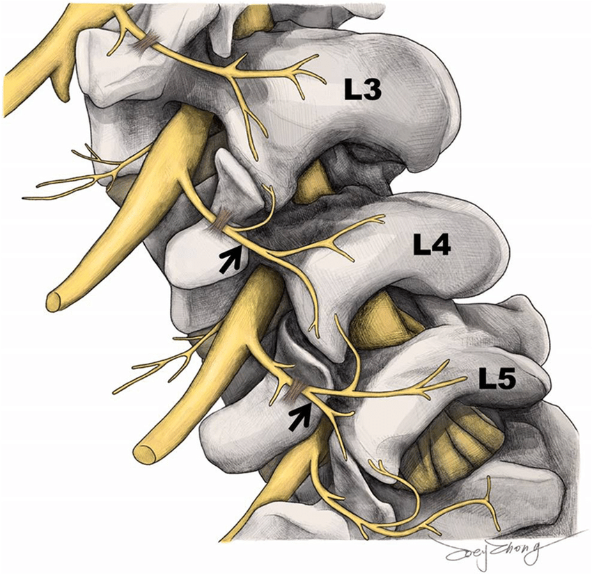 <p>M erector spinae / M multifidus / M semispinalis</p>