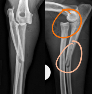 <p>Fracture with accompanying luxation</p>