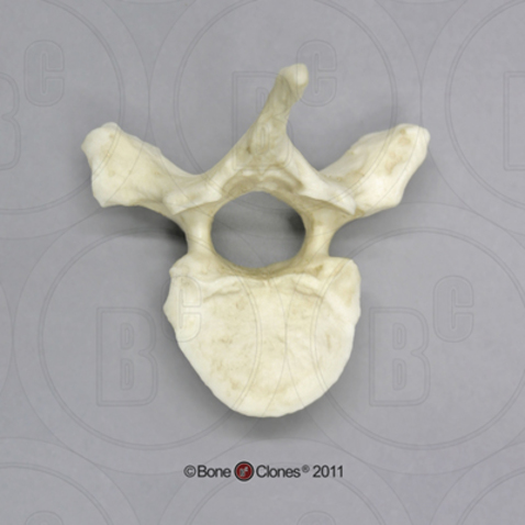 <p>what type of vertebrae is this</p>