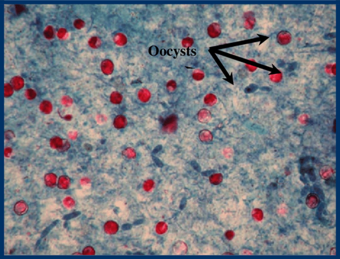 <p>Red/Pink Oocysts against a blue background</p>