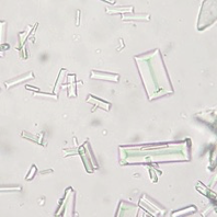 <p>What crystal is this?</p>