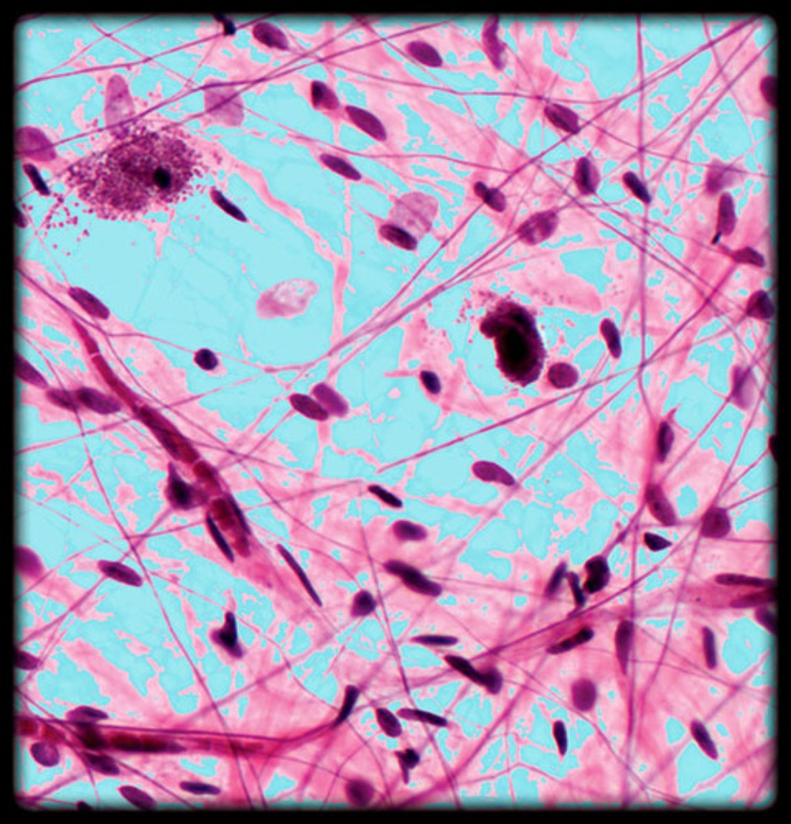 <p>unstructured material that fills the space between the cells and contains the fibers</p>